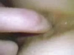 女同性恋者2的！ 药物为阴道壁痒